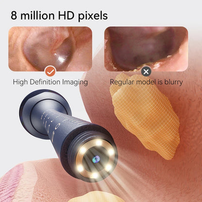 Oticlear Vision Pro
